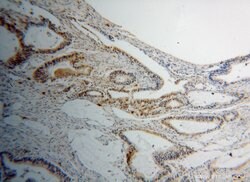PPIL1 Rabbit anti-Human, Mouse, Rat, Polyclonal, Proteintech 150 &mu;L;