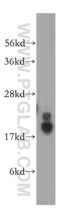 PPIL1 Rabbit anti-Human, Mouse, Rat, Polyclonal, Proteintech 150 &mu;L;