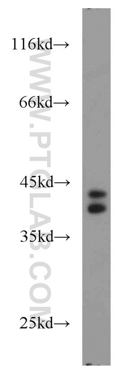 PIGK Rabbit anti-Human, Polyclonal, Proteintech 20 &mu;L; Unconjugated:Antibodies,