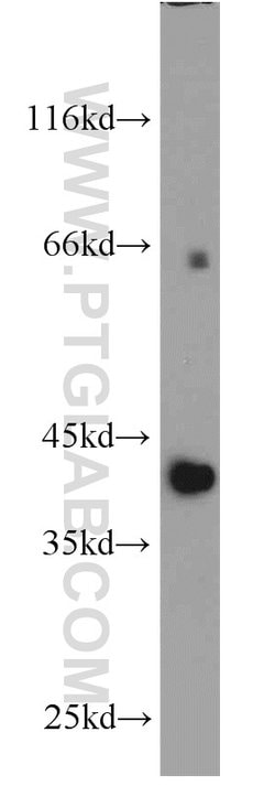 PIGK Rabbit anti-Human, Polyclonal, Proteintech 20 &mu;L; Unconjugated:Antibodies,
