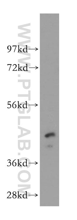 PIGK Rabbit anti-Human, Polyclonal, Proteintech 20 &mu;L; Unconjugated:Antibodies,