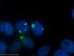 PSMB2 Rabbit anti-Human, Mouse, Rat, Polyclonal, Proteintech 150 &mu;L;