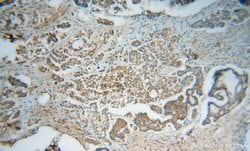 PSMB2 Rabbit anti-Human, Mouse, Rat, Polyclonal, Proteintech 150 &mu;L;