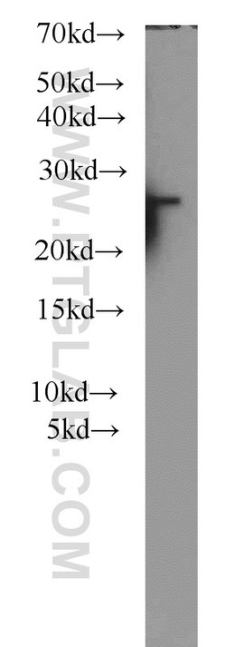 PSMB2 Rabbit anti-Human, Mouse, Rat, Polyclonal, Proteintech 150 &mu;L;