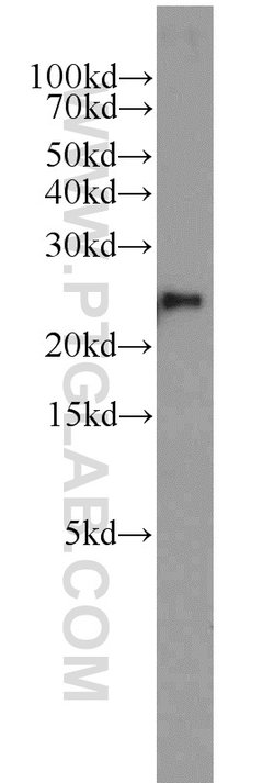 PSMB2 Rabbit anti-Human, Mouse, Rat, Polyclonal, Proteintech 150 &mu;L;