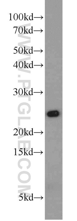 PSMB2 Rabbit anti-Human, Mouse, Rat, Polyclonal, Proteintech 150 &mu;L;