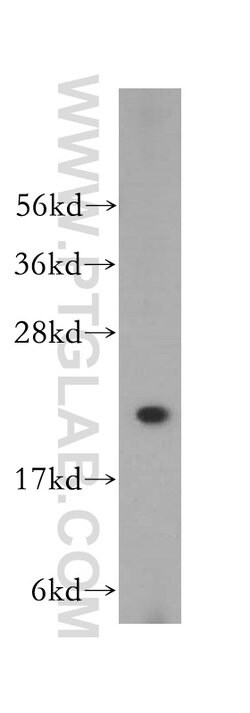 PSMB2 Rabbit anti-Human, Mouse, Rat, Polyclonal, Proteintech 150 &mu;L;