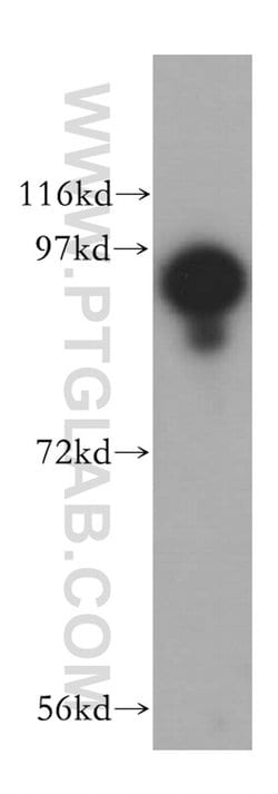 USP5 Rabbit anti-Human, Mouse, Rat, Polyclonal, Proteintech:Antibodies:Primary