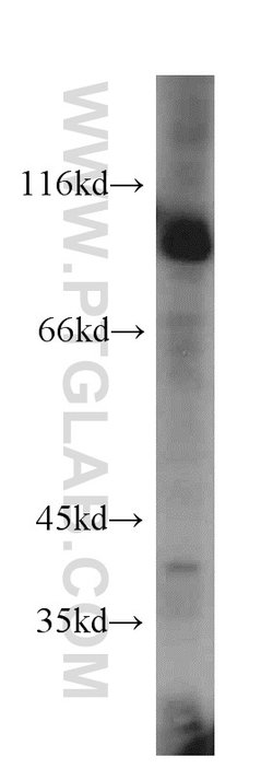 USP5 Rabbit anti-Human, Mouse, Rat, Polyclonal, Proteintech:Antibodies:Primary