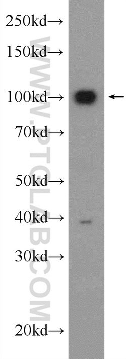 USP5 Rabbit anti-Human, Mouse, Rat, Polyclonal, Proteintech:Antibodies:Primary