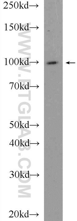 USP5 Rabbit anti-Human, Mouse, Rat, Polyclonal, Proteintech:Antibodies:Primary