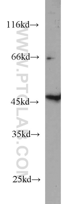 GALK2 Rabbit anti-Human, Mouse, Rat, Polyclonal, Proteintech:Antibodies:Primary