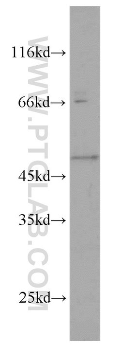 GALK2 Rabbit anti-Human, Mouse, Rat, Polyclonal, Proteintech:Antibodies:Primary