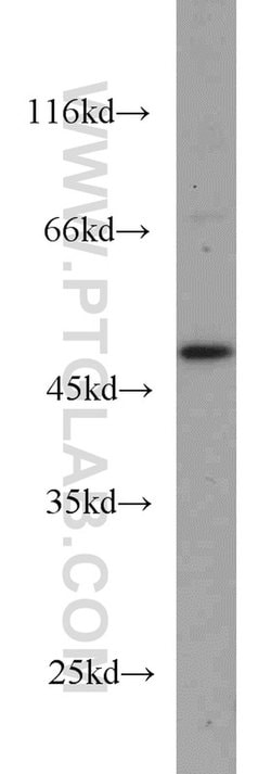 GALK2 Rabbit anti-Human, Mouse, Rat, Polyclonal, Proteintech:Antibodies:Primary