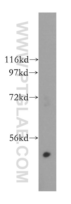 GALK2 Rabbit anti-Human, Mouse, Rat, Polyclonal, Proteintech:Antibodies:Primary