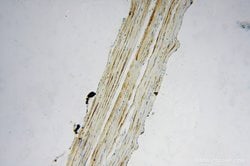 FEM1A Rabbit anti-Human, Polyclonal, Proteintech:Antibodies:Primary Antibodies