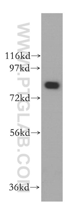 FEM1A Rabbit anti-Human, Polyclonal, Proteintech:Antibodies:Primary Antibodies