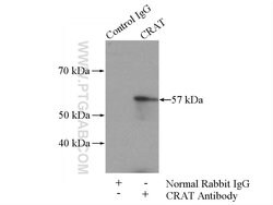 CRAT Rabbit anti-Human, Mouse, Rat, Polyclonal, Proteintech:Antibodies:Primary