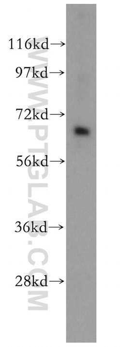 CRAT Rabbit anti-Human, Mouse, Rat, Polyclonal, Proteintech:Antibodies:Primary