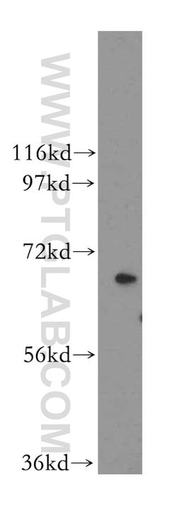 CRAT Rabbit anti-Human, Mouse, Rat, Polyclonal, Proteintech:Antibodies:Primary