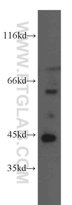 CA12 Rabbit anti-Human, Mouse, Rat, Polyclonal, Proteintech:Antibodies:Primary