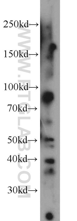 CA12 Rabbit anti-Human, Mouse, Rat, Polyclonal, Proteintech:Antibodies:Primary