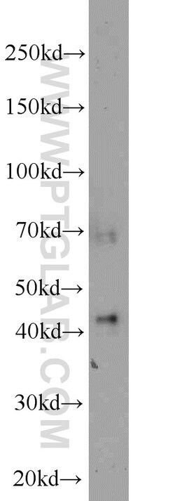 CA12 Rabbit anti-Human, Mouse, Rat, Polyclonal, Proteintech:Antibodies:Primary