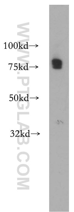 CA12 Rabbit anti-Human, Mouse, Rat, Polyclonal, Proteintech:Antibodies:Primary