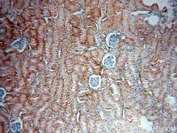 CA12 Rabbit anti-Human, Mouse, Rat, Polyclonal, Proteintech:Antibodies:Primary