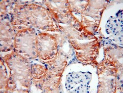 CA12 Rabbit anti-Human, Mouse, Rat, Polyclonal, Proteintech:Antibodies:Primary