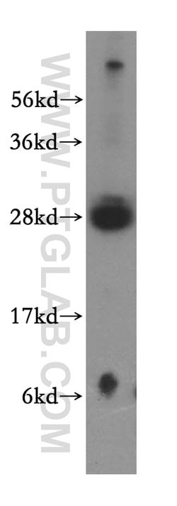 RBPMS Rabbit anti-Human, Mouse, Rat, Polyclonal, Proteintech 20 &mu;L;