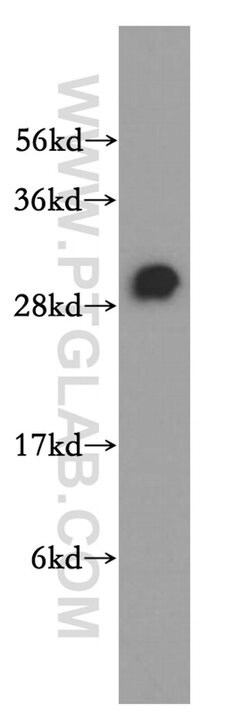 RBPMS Rabbit anti-Human, Mouse, Rat, Polyclonal, Proteintech 20 &mu;L;