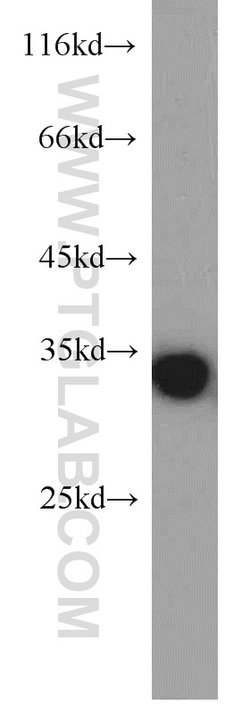 RPS3 Rabbit anti-Human, Mouse, Rat, Polyclonal, Proteintech 20 &mu;L; Unconjugated:Anticuerpos