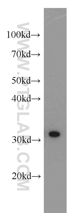 RPS3 Rabbit anti-Human, Mouse, Rat, Polyclonal, Proteintech 20 &mu;L; Unconjugated:Anticuerpos