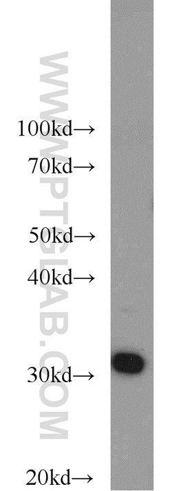 RPS3 Rabbit anti-Human, Mouse, Rat, Polyclonal, Proteintech 20 &mu;L; Unconjugated:Anticuerpos