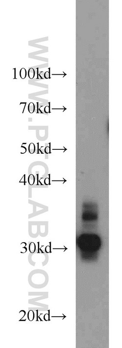 RPS3 Rabbit anti-Human, Mouse, Rat, Polyclonal, Proteintech 20 &mu;L; Unconjugated:Anticuerpos