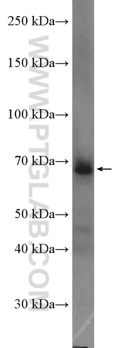 TFCP2 Rabbit anti-Human, Mouse, Rat, Polyclonal, Proteintech:Antibodies:Primary