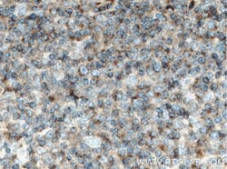 CRACR2A Rabbit anti-Human, Polyclonal, Proteintech 150 &mu;L; Unconjugated:Antibodies,