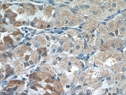 CHAC1 Rabbit anti-Human, Mouse, Rat, Polyclonal, Proteintech 150 &mu;L;