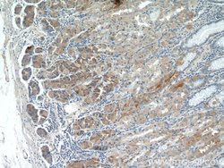 CHAC1 Rabbit anti-Human, Mouse, Rat, Polyclonal, Proteintech 150 &mu;L;