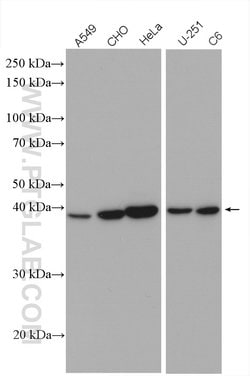 CHAC1 Rabbit anti-Human, Mouse, Rat, Polyclonal, Proteintech 150 &mu;L;