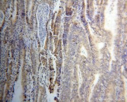 THG1L Rabbit anti-Human, Mouse, Rat, Polyclonal, Proteintech:Antibodies:Primary