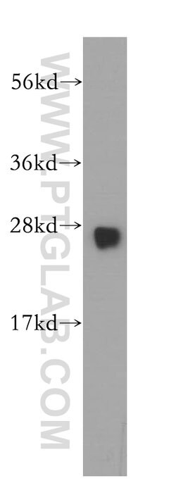 GSTM3 Rabbit anti-Human, Mouse, Rat, Polyclonal, Proteintech:Antibodies:Primary