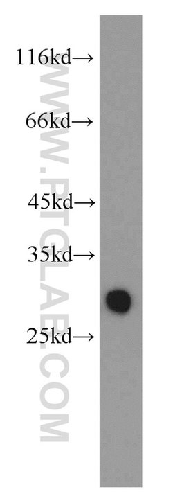 GSTM3 Rabbit anti-Human, Mouse, Rat, Polyclonal, Proteintech:Antibodies:Primary
