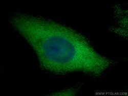 PTGES3 Rabbit anti-Human, Mouse, Rat, Polyclonal, Proteintech 150 &mu;L;