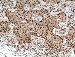 RPB5 Rabbit anti-Human, Mouse, Rat, Polyclonal, Proteintech:Antibodies:Primary