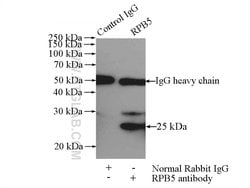 RPB5 Rabbit anti-Human, Mouse, Rat, Polyclonal, Proteintech:Antibodies:Primary