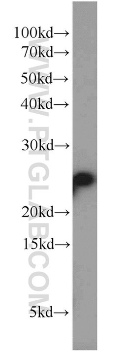 RPB5 Rabbit anti-Human, Mouse, Rat, Polyclonal, Proteintech:Antibodies:Primary