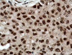 RPB5 Rabbit anti-Human, Mouse, Rat, Polyclonal, Proteintech