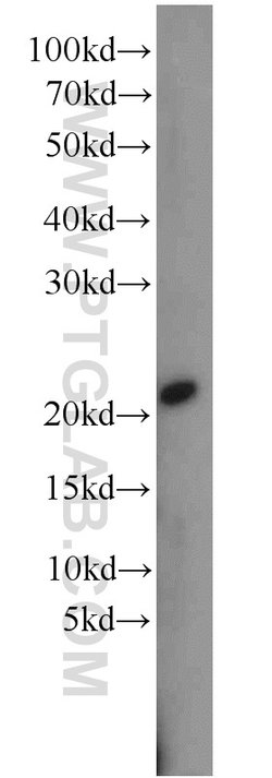 RPB5 Rabbit anti-Human, Mouse, Rat, Polyclonal, Proteintech:Antibodies:Primary
